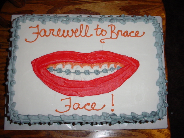 bracefacecake